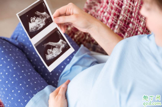 孕期营养不良影响胎儿发育吗 怎样确认宝宝在肚子里好好的3