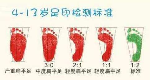 扁平足能跑步吗？扁平足跑步有什么危害？